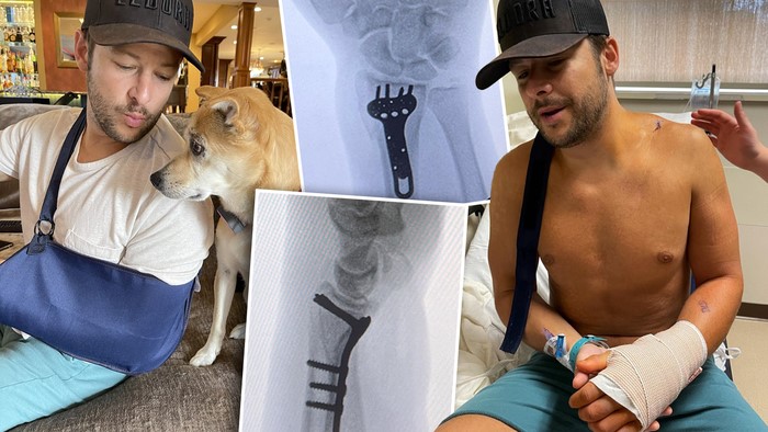 SRX champion has surgery to repair broken wrist